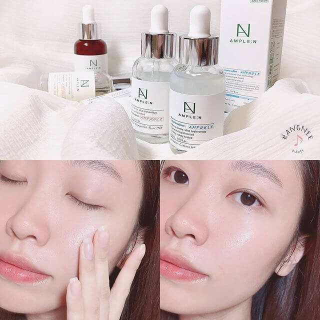 Coreana,Coreana AMPLE:N Hyaluron Shot,Coreana AMPLE:N Hyaluron Shot Ampoule,Coreana AMPLE:N Hyaluron Shot Ampoule ราคา,Coreana AMPLE:N Hyaluron Shot Ampoule รีวิว,Coreana AMPLE:N Hyaluron Shot Ampoule pantip,Coreana AMPLE:N Hyaluron Shot Ampoule jeban,Coreana AMPLE:N Hyaluron Shot Ampoule twitter