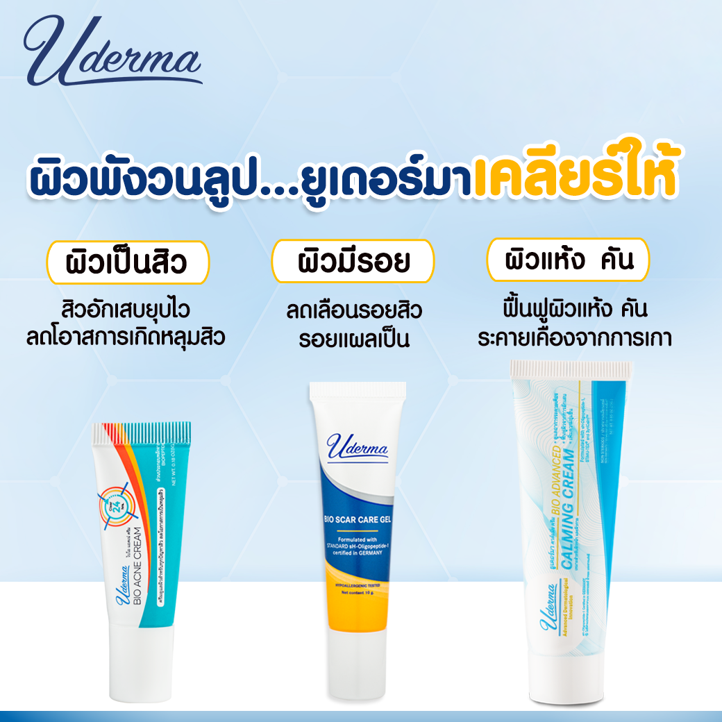 Uderma, Uderma รีวิว, Uderma ราคา, Uderma Bio Acne Cream, Uderma Bio Acne Cream รีวิว, Uderma Bio Acne Cream 5g, Uderma Bio Acne Cream 5g ครีมแต้มสิว, ครีมแต้มสิว, Uderma ครีมแต้มสิว